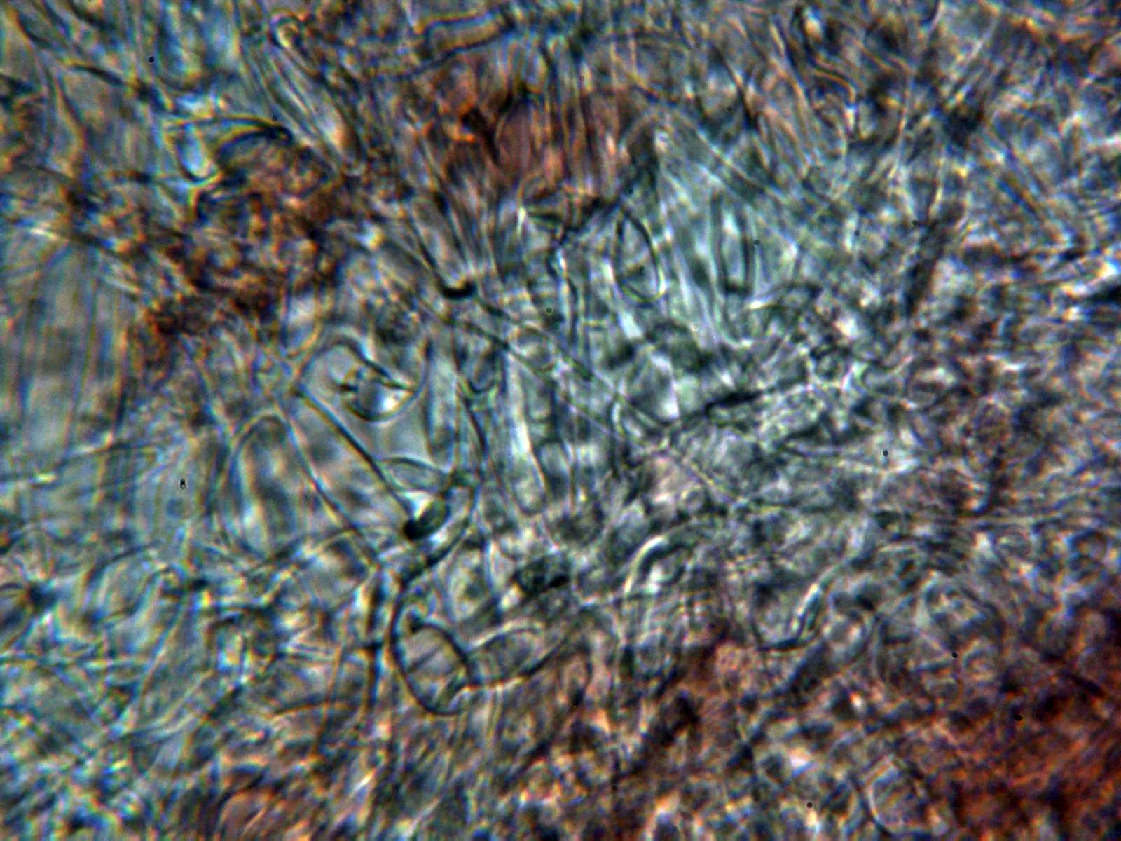 10 - Excípulo medular